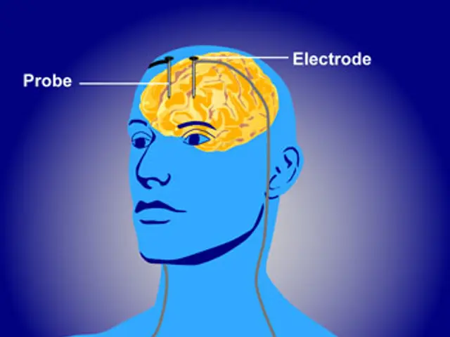 The image shows a diagram of a man's head with electrodes attached to it, indicating that he is...